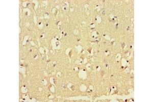 Immunohistochemistry of paraffin-embedded human brain tissue using ABIN7172553 at dilution of 1:100 (GATA6 antibody  (AA 496-595))