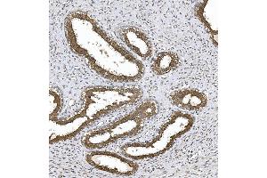 IHC analysis of PKC Theta/PRKCQ using anti-PKC Theta/PRKCQ antibody (ABIN7600767). (PKC theta antibody  (AA 23-706))