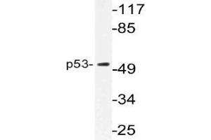 Western blot (WB) analysis of p53 antibody in extracts from K562 cells. (p53 antibody)