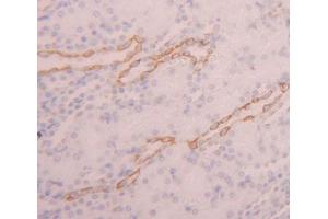 Used in DAB staining on fromalin fixed paraffin- embedded kidney tissue (PDE3A antibody  (AA 948-1141))