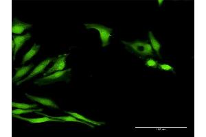 Immunofluorescence of purified MaxPab antibody to LOC541473 on HeLa cell. (LOC541473 antibody  (AA 1-131))