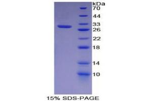 SDS-PAGE (SDS) image for Proopiomelanocortin (POMC) (AA 27-235) protein (His tag) (ABIN2126442)
