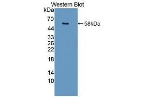 Western blot analysis of the recombinant protein. (MMP15 antibody  (AA 280-497))