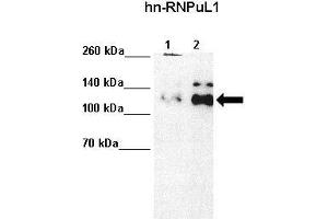 Lanes :  Lane 1: 5ug HeLa S3 Lane 2: 10ug HeLa S3   Primary Antibody Dilution :   1:4000    Secondary Antibody :  Anti-rabbit-HRP   Secondary Antibody Dilution :   1:5000   Gene Name :  HNRPUL1   Submitted by :  Anonymous (HNRNPUL1 antibody  (C-Term))
