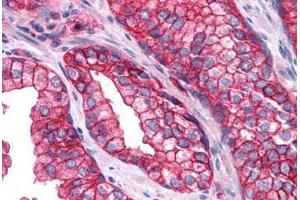 Human Prostate: Formalin-Fixed, Paraffin-Embedded (FFPE) (SNAP23 antibody  (AA 1-132))
