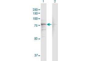 Western Blot analysis of CACNB1 expression in transfected 293T cell line by CACNB1 MaxPab polyclonal antibody. (CACNB1 antibody  (AA 1-598))