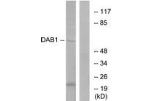 Western blot analysis of extracts from HeLa cells, using Dab1 (Ab-220) Antibody. (DAB1 antibody  (AA 187-236))