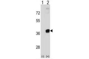 Western blot analysis of PRPS2 (arrow) using rabbit polyclonal PRPS2 Antibody (Center) . (PRPS2 antibody  (Middle Region))