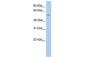 Western Blot showing LIMD1 antibody used at a concentration of 1. (LIMD1 antibody  (N-Term))