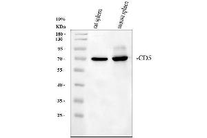 Western blot analysis of CD5 using anti-CD5 antibody (ABIN5693203). (CD5 antibody  (AA 25-495))