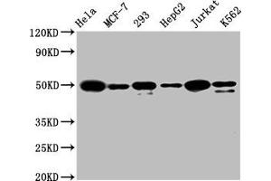 Western Blot Positive WB detected in: Hela whole cell lysate, MCF-7 whole cell lysate, 293 whole cell lysate, HepG2 whole cell lysate, Jurkat whole cell lysate, K562 whole cell lysate All lanes: ATF4 antibody at 1. (Recombinant ATF4 antibody)