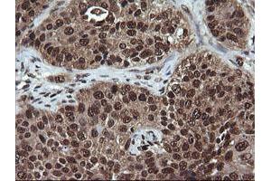 Image no. 2 for anti-Von Hippel-Lindau Tumor Suppressor, E3 Ubiquitin Protein Ligase (VHL) antibody (ABIN1501712) (VHL antibody)