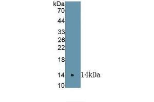 Detection of Recombinant COX 2, Rat using Polyclonal Antibody to Cyclooxygenase-2 (COX 2) (PTGS2 antibody)