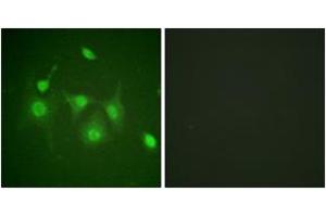 Immunofluorescence analysis of HepG2 cells, using HDAC6 (Ab-22) Antibody. (HDAC6 antibody  (AA 7-56))