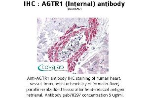 Image no. 1 for anti-Angiotensin II Receptor, Type 1 (AGTR1) (Internal Region) antibody (ABIN1731610) (Angiotensin II Type-1 Receptor antibody  (Internal Region))