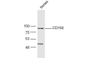 Mouse bone lysate 30ug, probed with Anti-CD168 Polyclonal Antibody  at 1:5000 90min in 37˚C. (HMMR antibody  (AA 51-150))