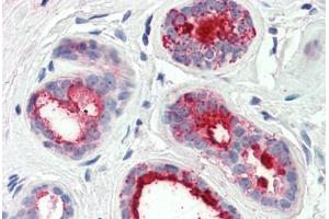 Human Breast (formalin-fixed, paraffin-embedded) stained with PIP antibody ABIN337224 at 2. (PIP antibody  (AA 24-34))