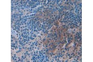 Figure. (GZMM antibody  (AA 31-257))
