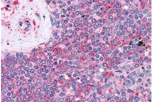 anti-Leukocyte Specific Transcript 1 (LST1) antibody