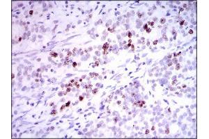 Immunohistochemistry (IHC) image for anti-Inner Centromere Protein Antigens 135/155kDa (INCENP) (AA 369-583) antibody (ABIN1844019) (INCENP antibody  (AA 369-583))