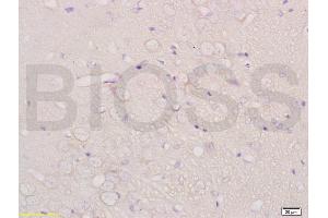 Formalin-fixed and paraffin embedded rat brain labeled with Anti-CHRNA4 Polyclonal Antibody, Unconjugated (ABIN736746) at 1:200 followed by conjugation to the secondary antibody and DAB staining. (CHRNA4 antibody  (AA 531-627))