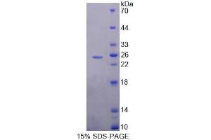 SDS-PAGE analysis of Mouse MEF2A Protein.