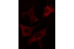 ABIN6274663 staining LOVO cells by IF/ICC. (CYP7B1 antibody  (Internal Region))