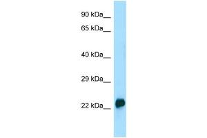 WB Suggested Anti-CRYGA Antibody Titration: 1. (CRYGA antibody  (N-Term))