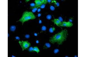 Anti-ARFGAP1 mouse monoclonal antibody (ABIN2454382) immunofluorescent staining of COS7 cells transiently transfected by pCMV6-ENTRY ARFGAP1 (RC206987). (ARFGAP1 antibody)