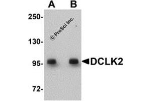 Western Blotting (WB) image for anti-Doublecortin-Like Kinase 2 (DCLK2) (C-Term) antibody (ABIN1030358) (DCLK2 antibody  (C-Term))