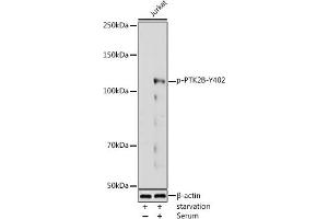 Western blot analysis of extracts of Jurkat cells, using Phospho-PTK2B-Y402 antibody (ABIN3019826, ABIN3019827, ABIN3019828 and ABIN7101865) at 1:1000 dilution. (PTK2B antibody  (pTyr402))