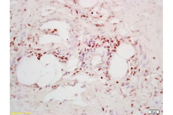 TPD52 antibody  (AA 141-190)