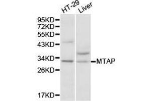 Western Blotting (WB) image for anti-Methylthioadenosine phosphorylase (MTAP) antibody (ABIN1875403)
