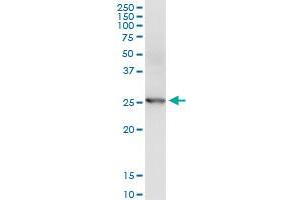 Immunoprecipitation (IP) image for anti-Cyclin-Dependent Kinase 20 (CDK20) (AA 1-275) antibody (ABIN525247)