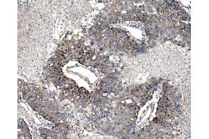 IHC analysis of Claudin 3/CLDN3 using anti-Claudin 3/CLDN3 antibody (ABIN7599626).