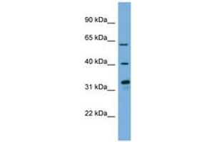 Image no. 1 for anti-Flavin Containing Monooxygenase 3 (FMO3) (N-Term) antibody (ABIN6744773)