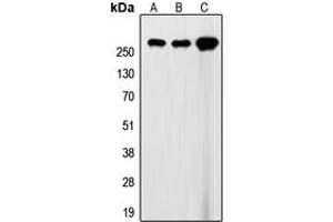 Western blot analysis of Filamin A expression in HEK293T (A), SP2/0 (B), rat heart (C) whole cell lysates. (Filamin A antibody  (C-Term))