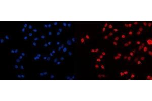 IF analysis of HDAC2 using anti-HDAC2 antibody (ABIN7601564).