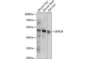 Western blot analysis of extracts of various cell lines, using LMX1B antibody (ABIN6133792, ABIN6143278, ABIN6143281 and ABIN6218228) at 1:1000 dilution. (LMX1B antibody  (AA 1-100))