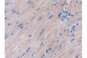 Immunohistochemistry (IHC) image for anti-Ferritin, Mitochondrial (FTMT) (AA 54-229) antibody (ABIN7437572)