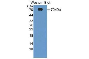 Western blot analysis of the recombinant protein. (HABP2 antibody  (AA 24-560))