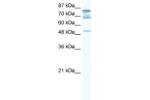 Western Blotting (WB) image for anti-DEAD (Asp-Glu-Ala-Asp) Box Polypeptide 46 (DDX46) antibody (ABIN2461582) (DDX46 antibody)