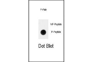 Dot blot analysis of anti-Phospho-RUNX2-p Antibody  on nitrocellulose membrane. (RUNX2 antibody  (pSer465))