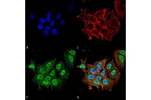 Immunocytochemistry/Immunofluorescence analysis using Mouse Anti-Ataxin 1 Monoclonal Antibody, Clone S76-8 . (Ataxin 1 antibody  (AA 164-197) (Atto 594))