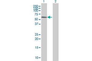 Western Blot analysis of ZNF502 expression in transfected 293T cell line by ZNF502 MaxPab polyclonal antibody. (ZNF502 antibody  (AA 1-544))