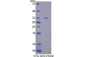 Image no. 1 for Matrix Metalloproteinase 20 (MMP20) (AA 137-398) protein (His tag) (ABIN4988907) (MMP20 Protein (AA 137-398) (His tag))