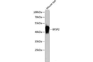 Western blot analysis of extracts of Mouse eye using BFSP2 Polyclonal Antibody at dilution of 1:3000. (BFSP2 antibody)