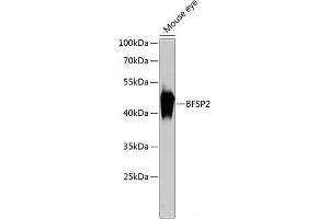 Western blot analysis of extracts of Mouse eye using BFSP2 Polyclonal Antibody at dilution of 1:3000.
