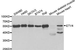 Western blot analysis of extracts of various cell lines, using ETV4 antibody. (ETV4 antibody)