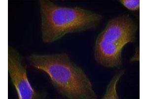 Immunofluorescent staining of methanol-fixed Hela cells using PRKCQ (phospho S676) polyclonal antibody  at 1:100-1:200 dilution.
